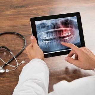 implanty Импланты